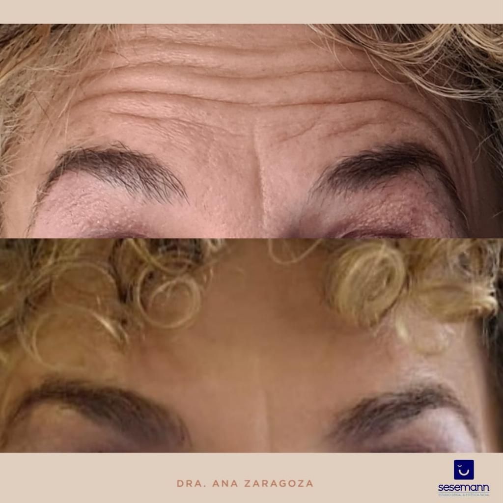 Paula Cano Carrillo-34