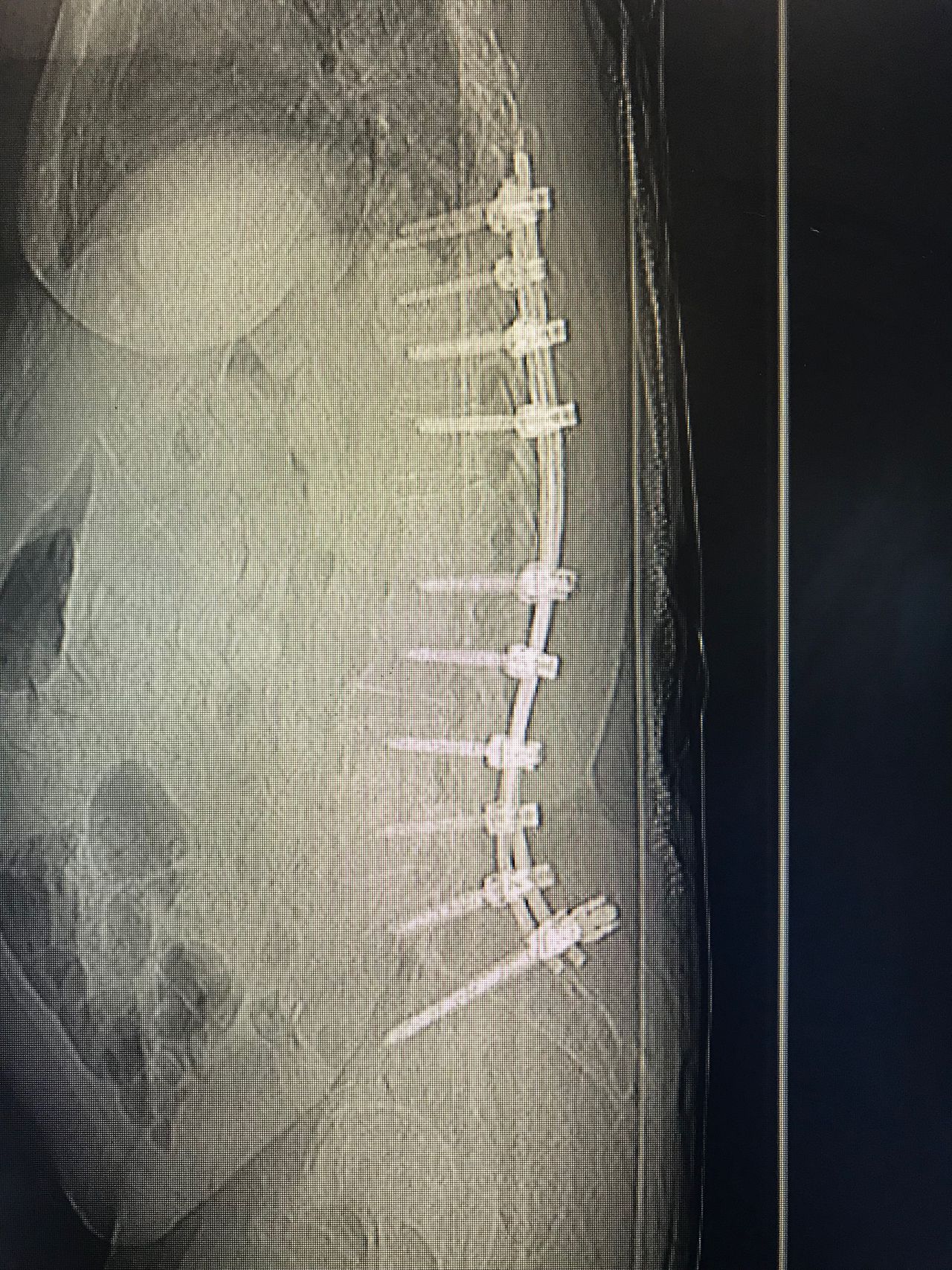 Juan Camilo Hernandez Acevedo-21