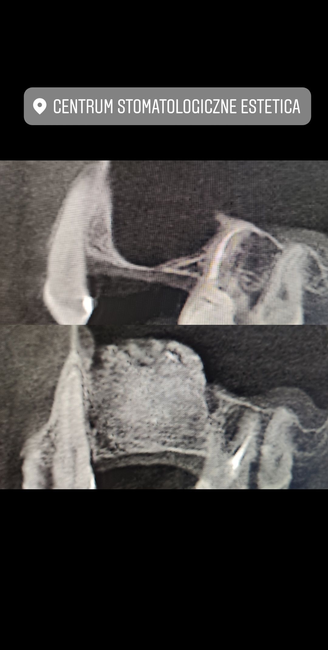 Paweł Poniatowski-21