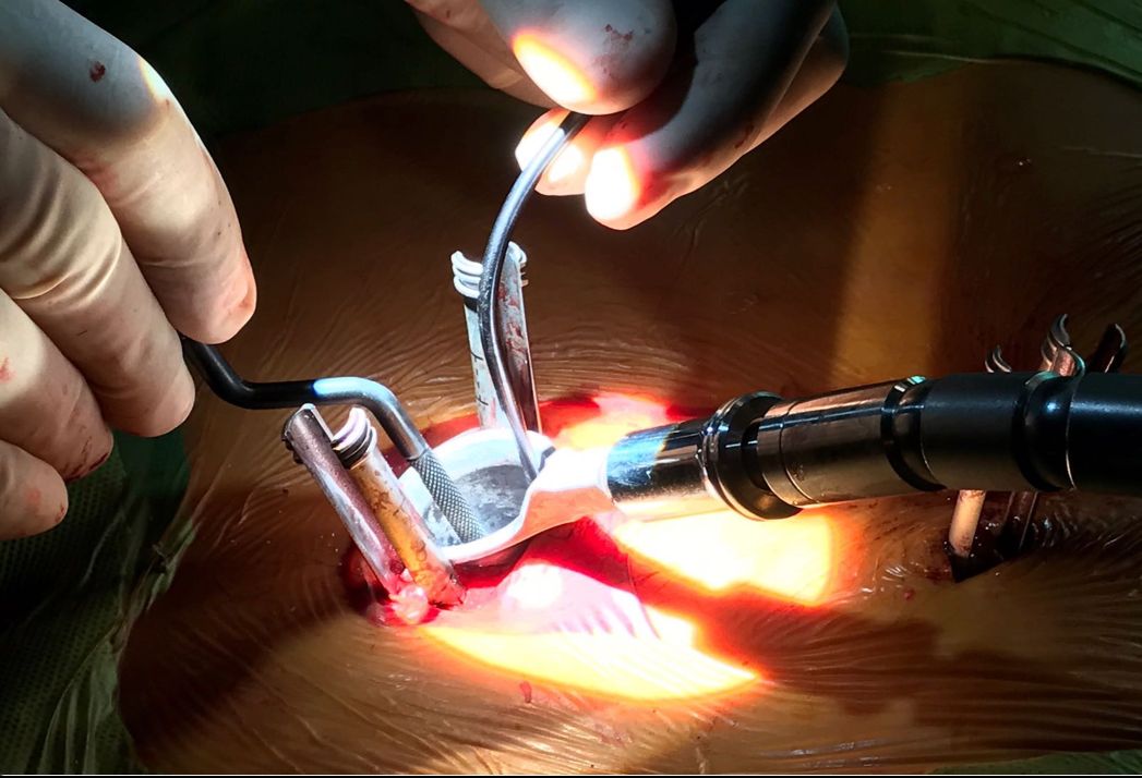 Avelino Parajón Díaz-2