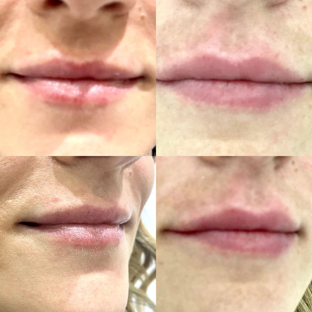 Pasquale Virciglio-38