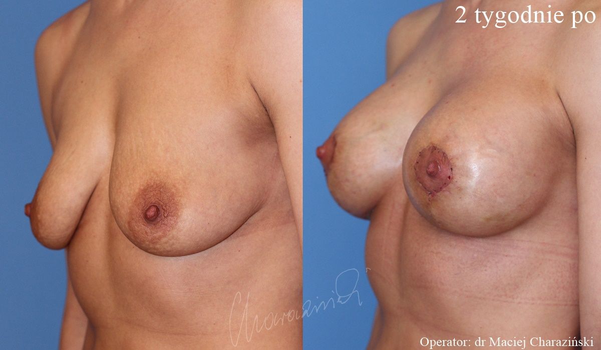 Maciej Charaziński-131