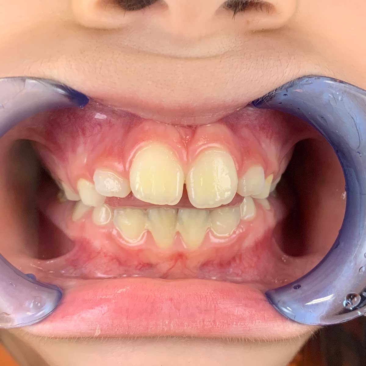 Gianluigi Bittante-41