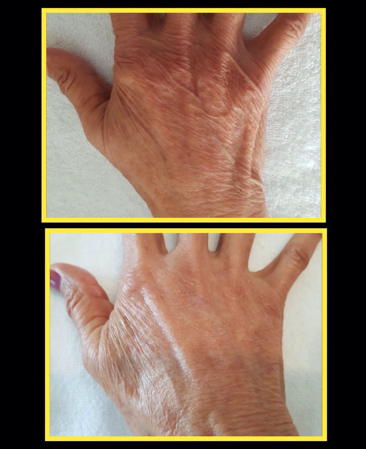 Rosalba Herrero Zerpa-418