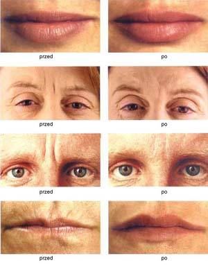 Marzenna Majcherczyk-Skulimowska-2