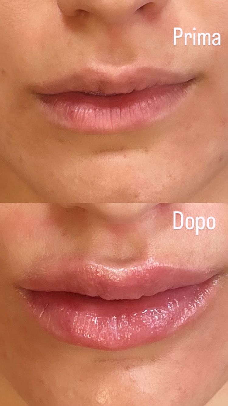 Alberto Alessandri-2