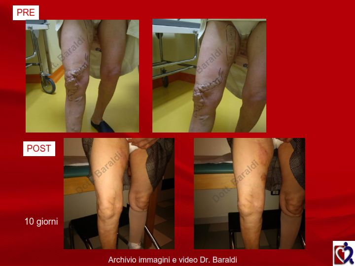 Christian Baraldi-11