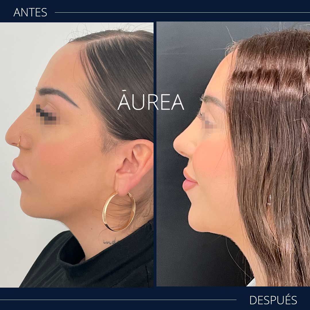 Ana Martínez Padilla-2