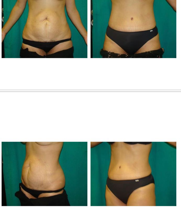 Esther Espinel Pérez-3