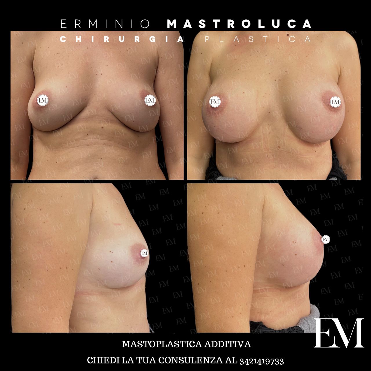 Erminio Mastroluca-20