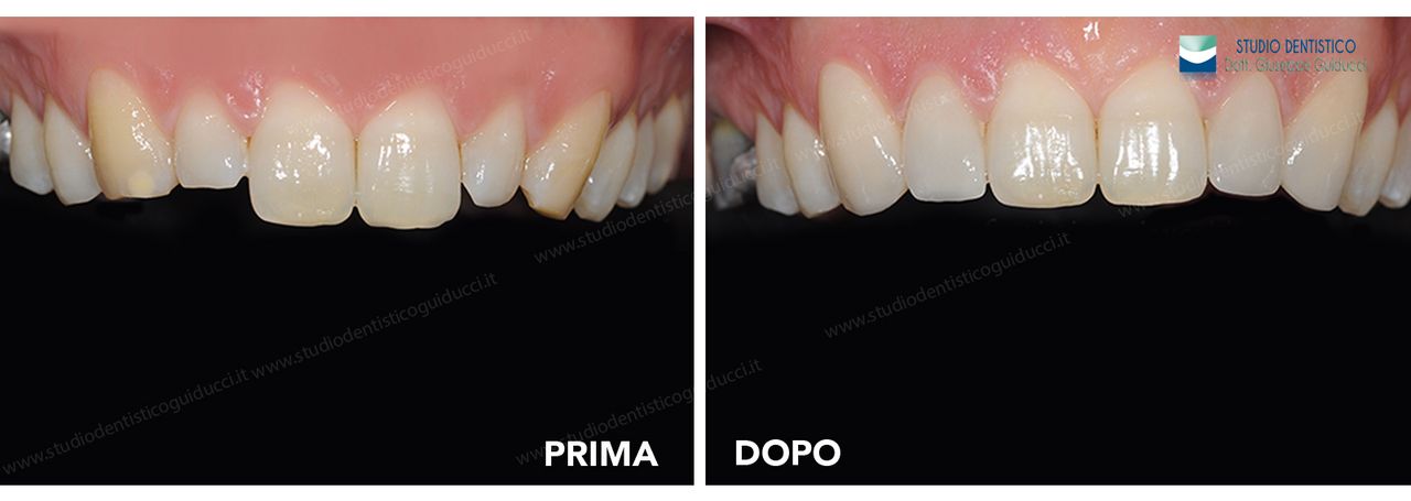 Giuseppe Guiducci-12