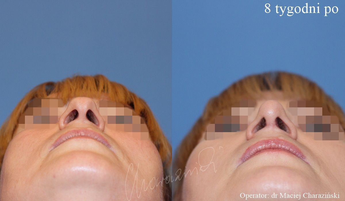 Maciej Charaziński-30