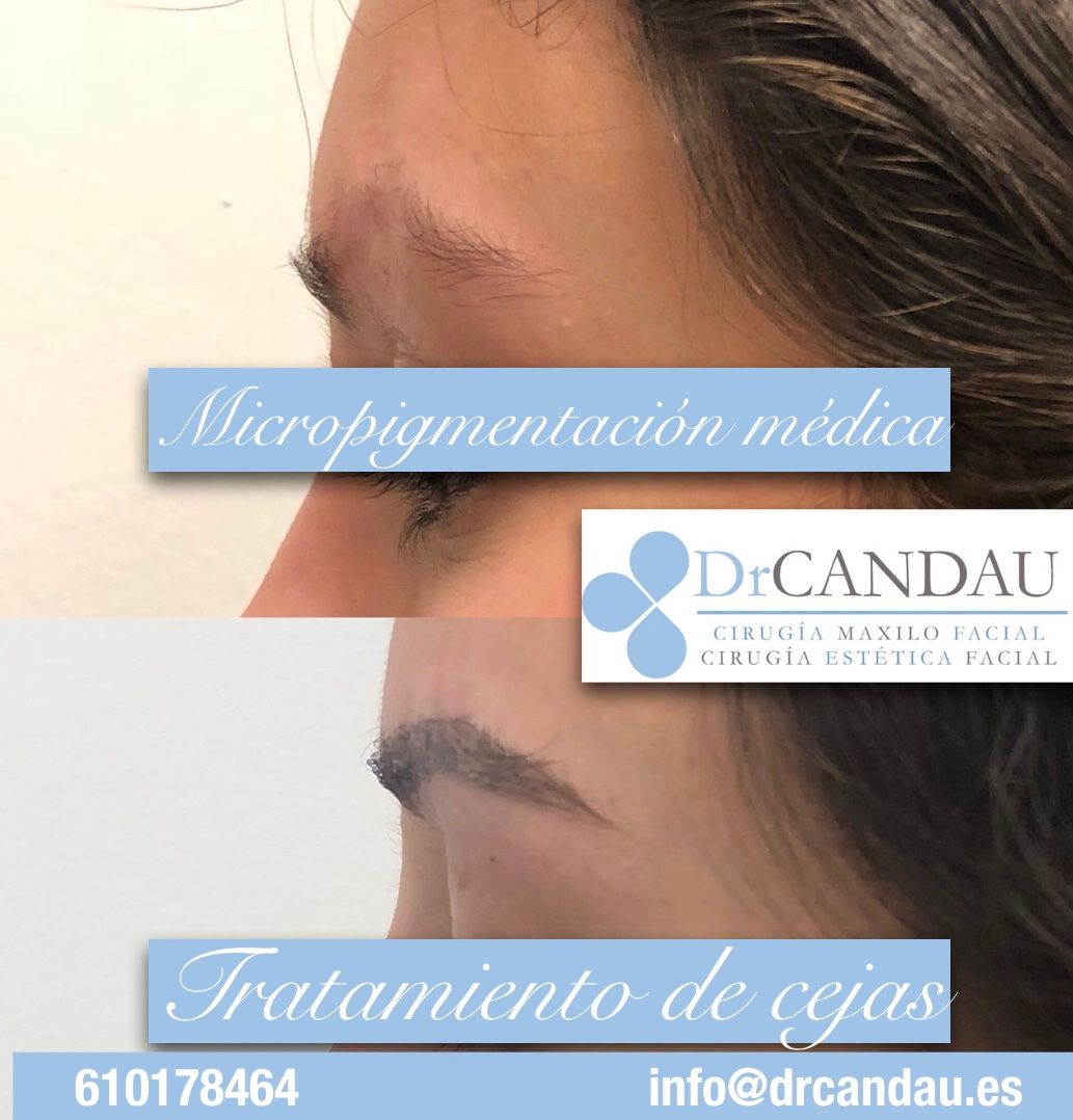 Alberto Candau Álvarez-31