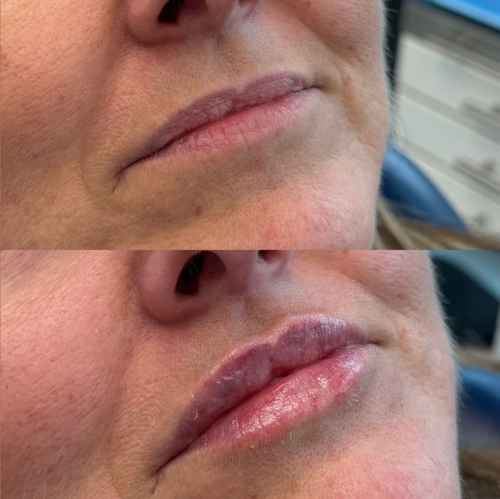 Pierfederico Perazzini-3