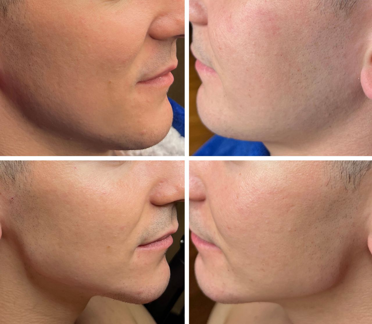 Magdalena Tworek (Słomka)-2