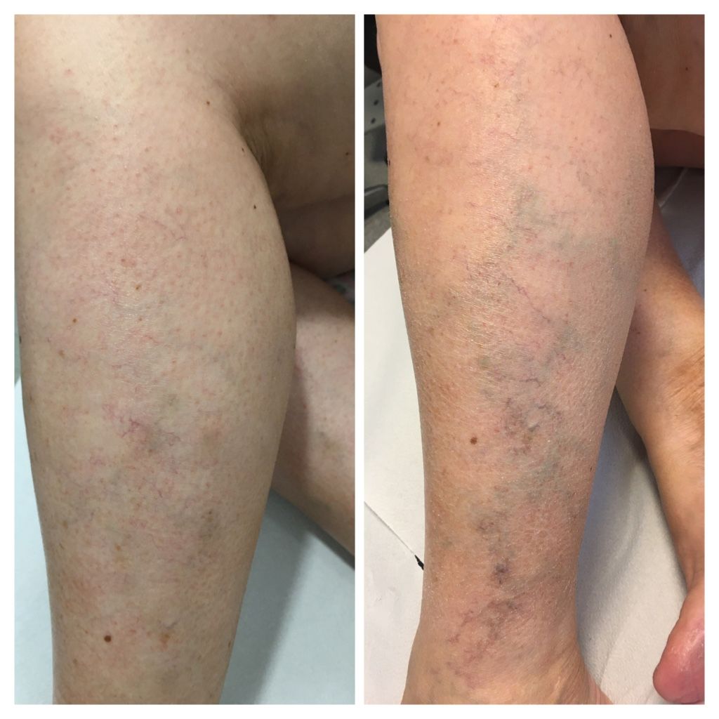 Arnaldo Strazzaboschi-12