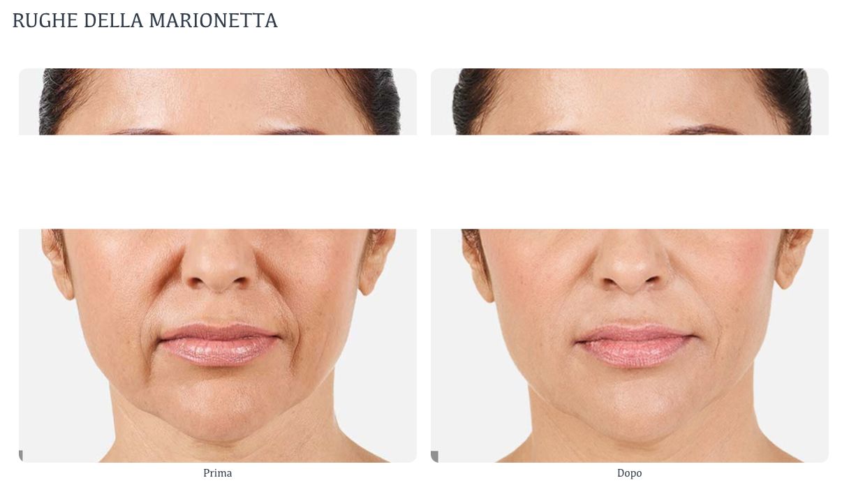 Susanne Innocenti-16