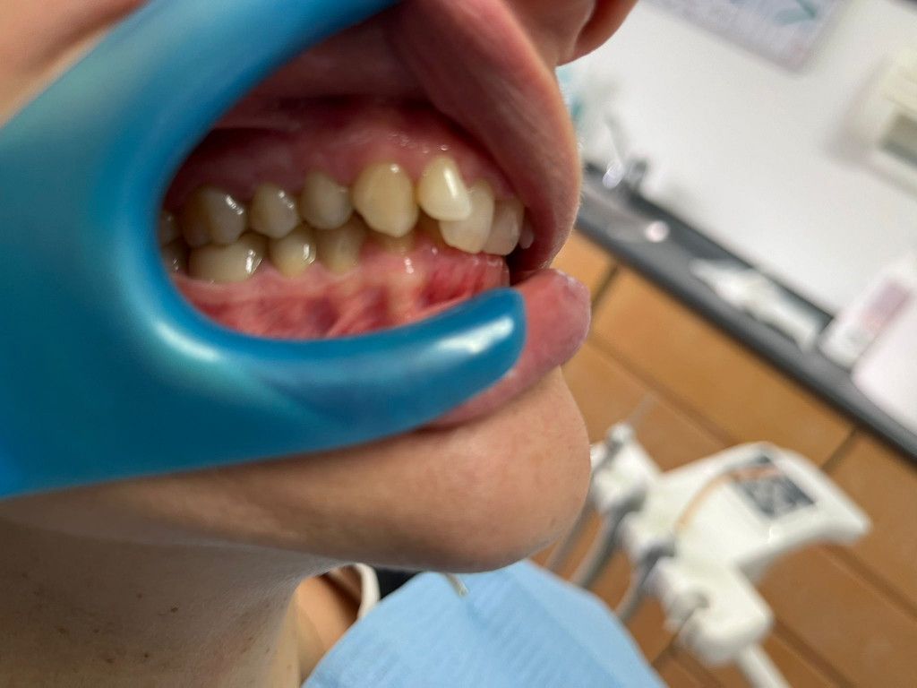 Riunito Dentista Dentalpar-10