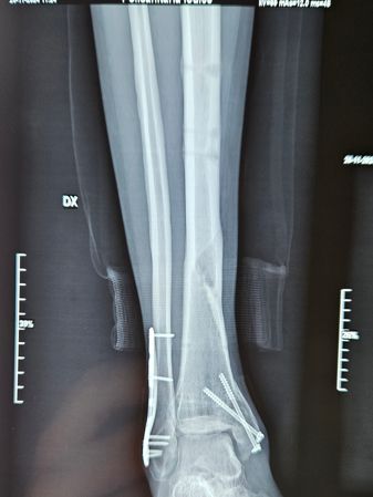 Gennaro Campopiano-8