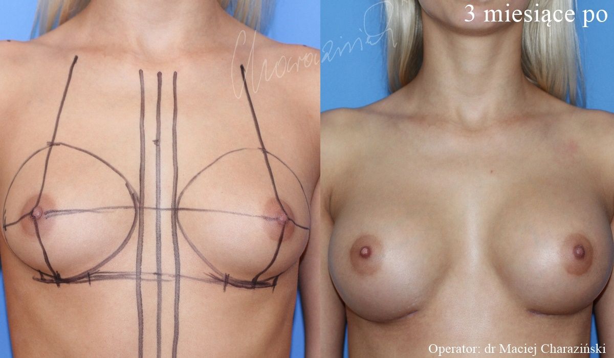 Maciej Charaziński-114