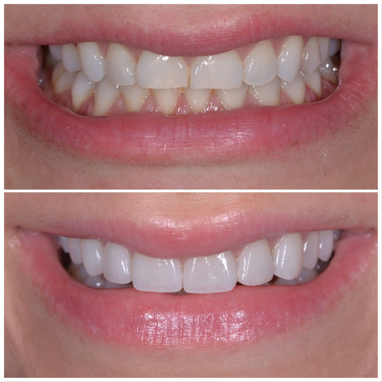 Martin Bartoszcze-23