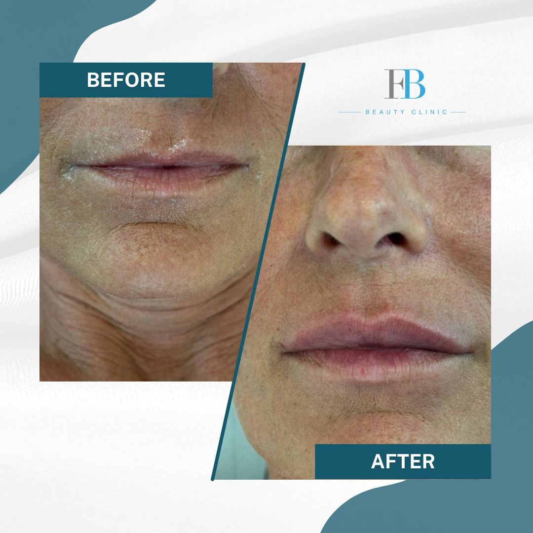 Francesco Bellucci-4