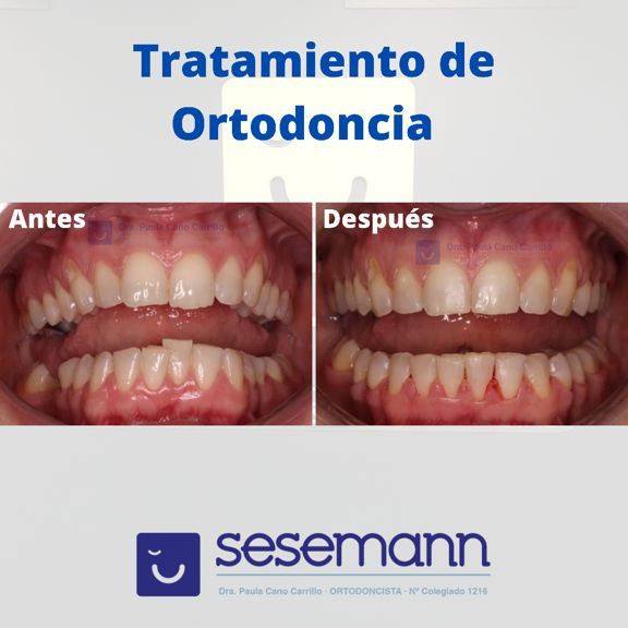 Paula Cano Carrillo-92