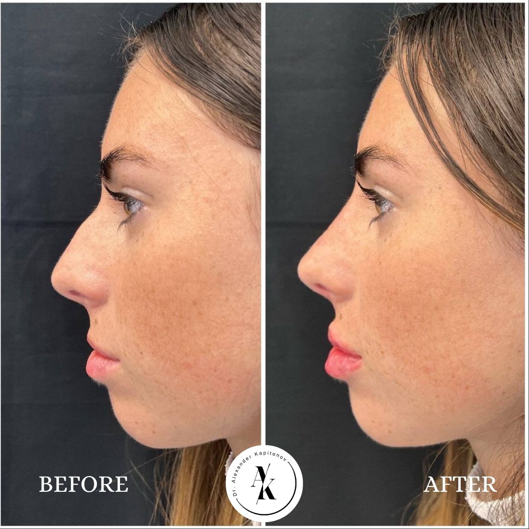 Alexandr Kapitonov-10