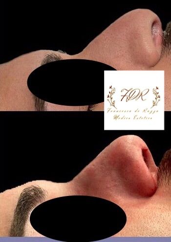 Francesca De Razza-31