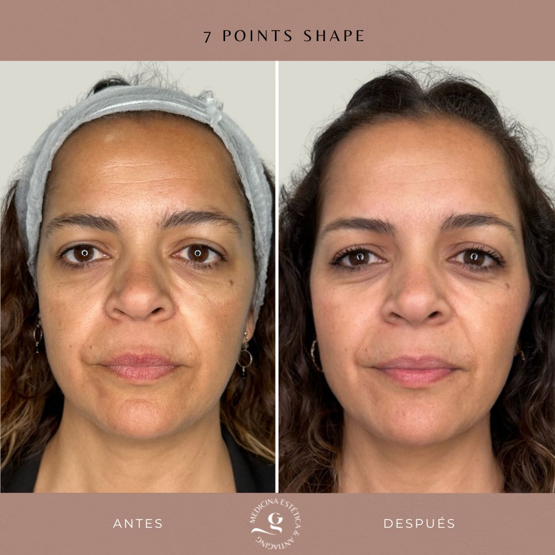 ​Giovanni Giorgianni-4