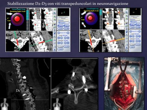 Francesco Marzetti-2