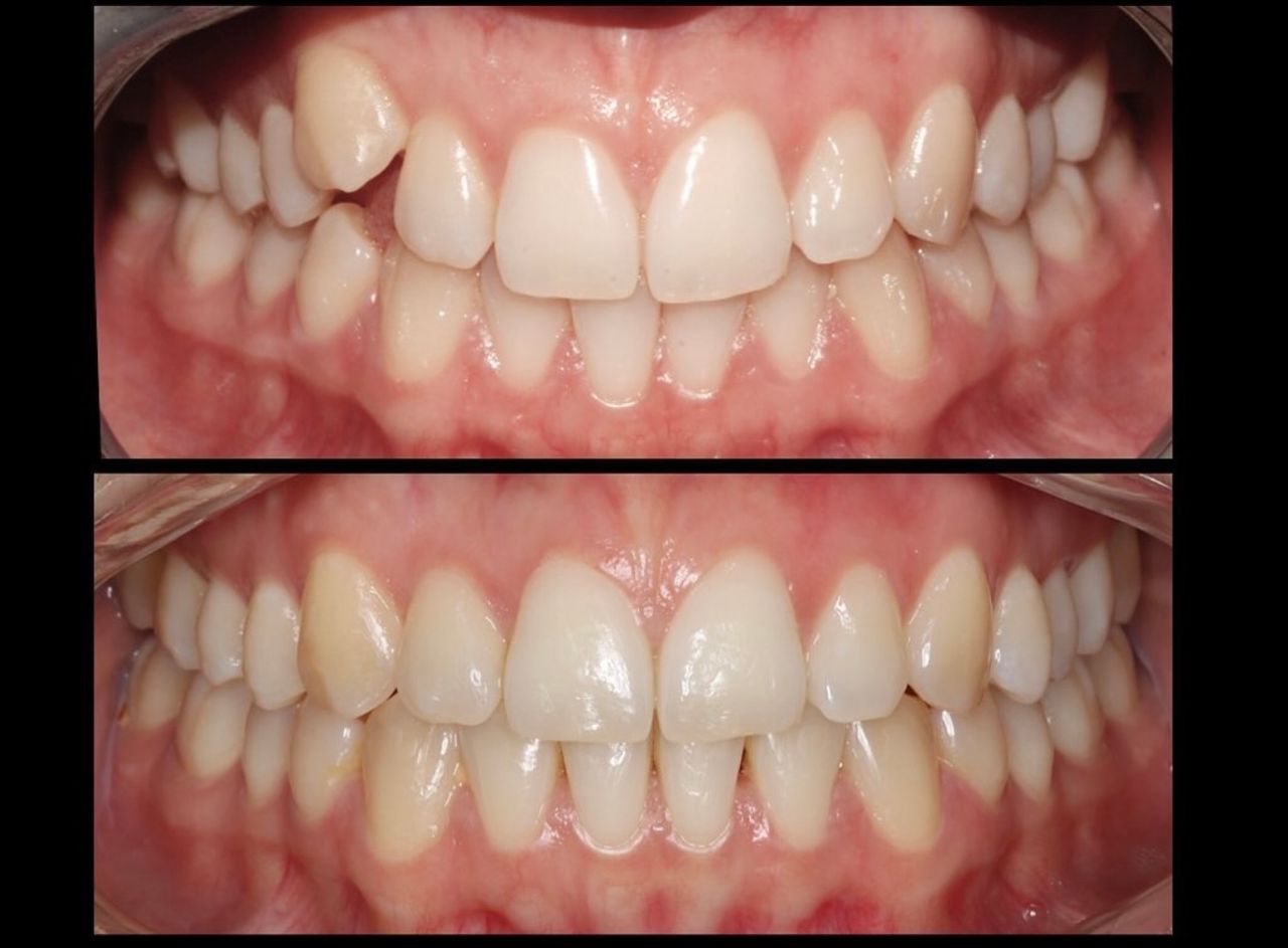 Francesco Sorrentino-8