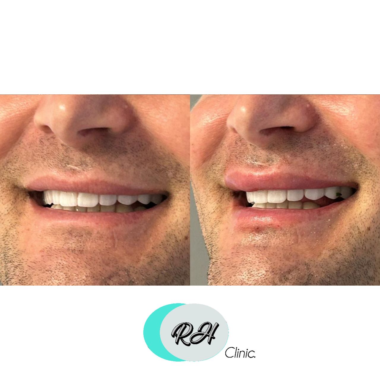 Rosalba Herrero Zerpa-110