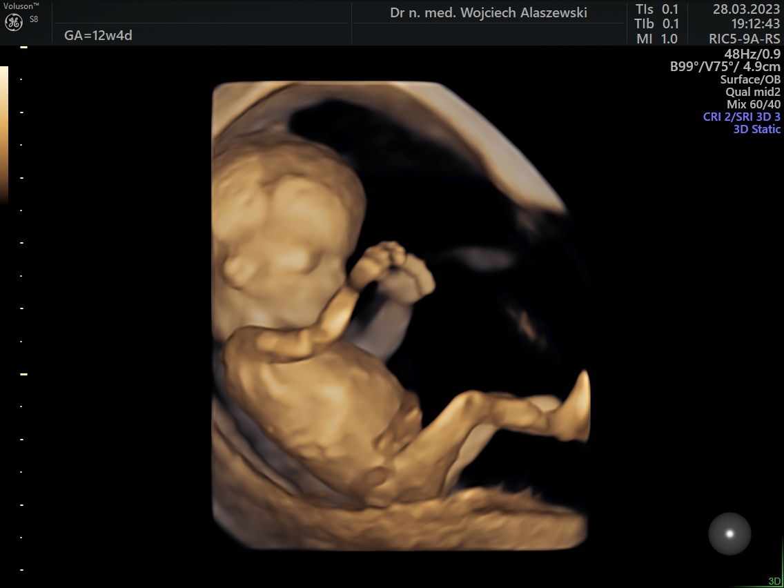 Wojciech Jan Ałaszewski-3