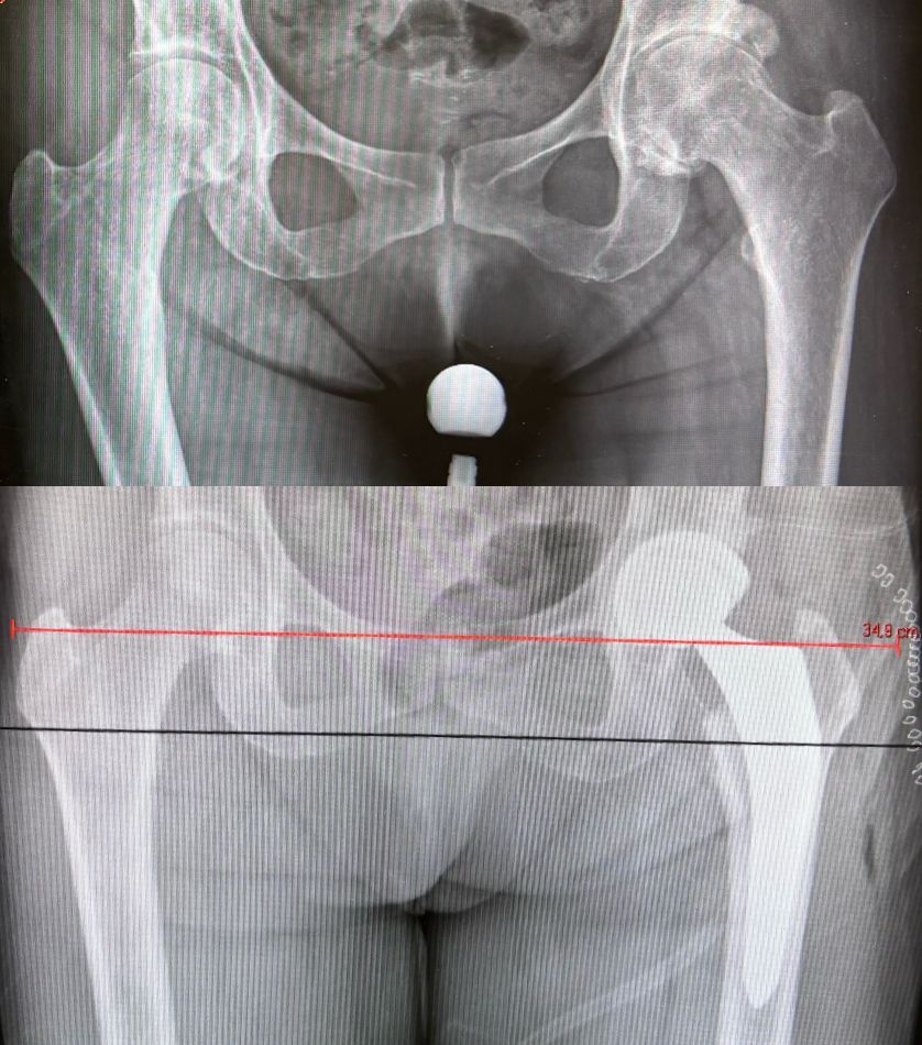 Alessandro Del Monaco-5