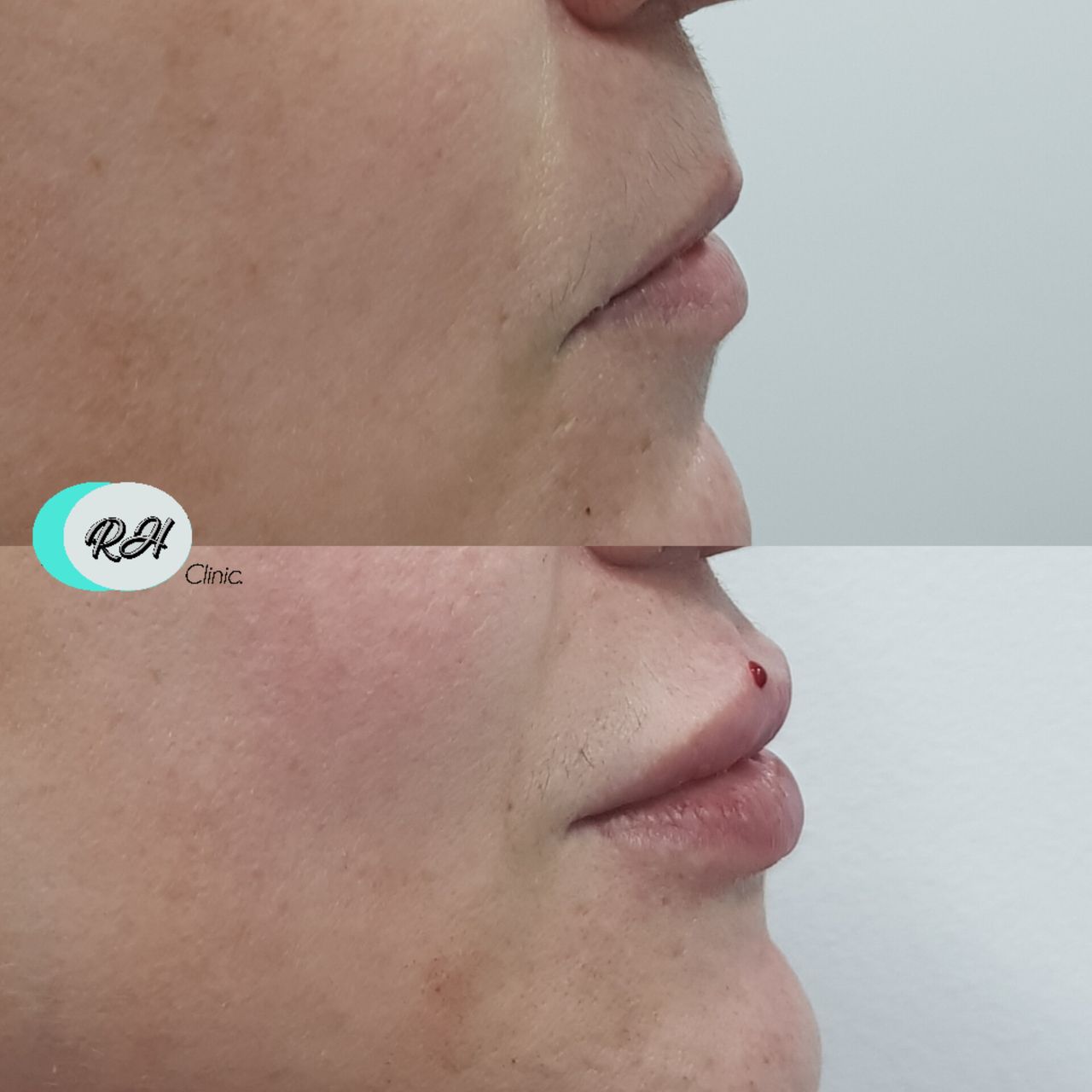 Rosalba Herrero Zerpa-80