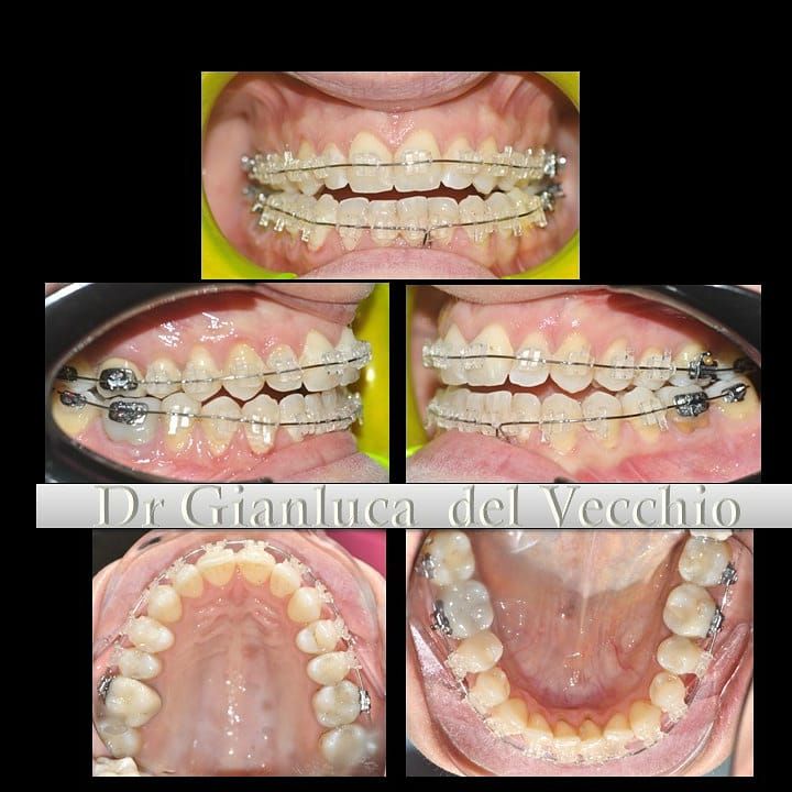 Gianluca Del Vecchio-42