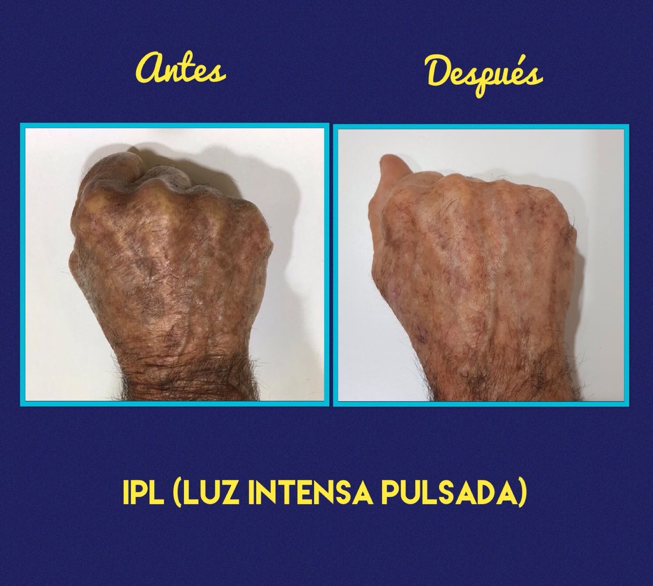 Rosalba Herrero Zerpa-414