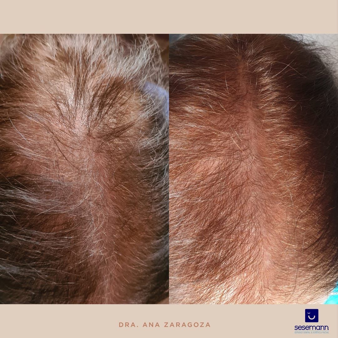 Paula Cano Carrillo-32