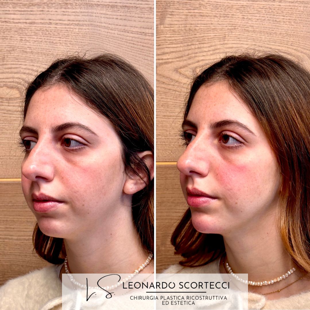 Leonardo Scortecci-12