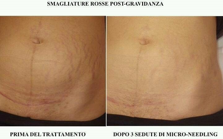 Stefano Maria Serini-6