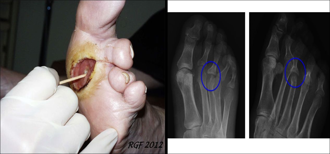 Francesco De Santis-18