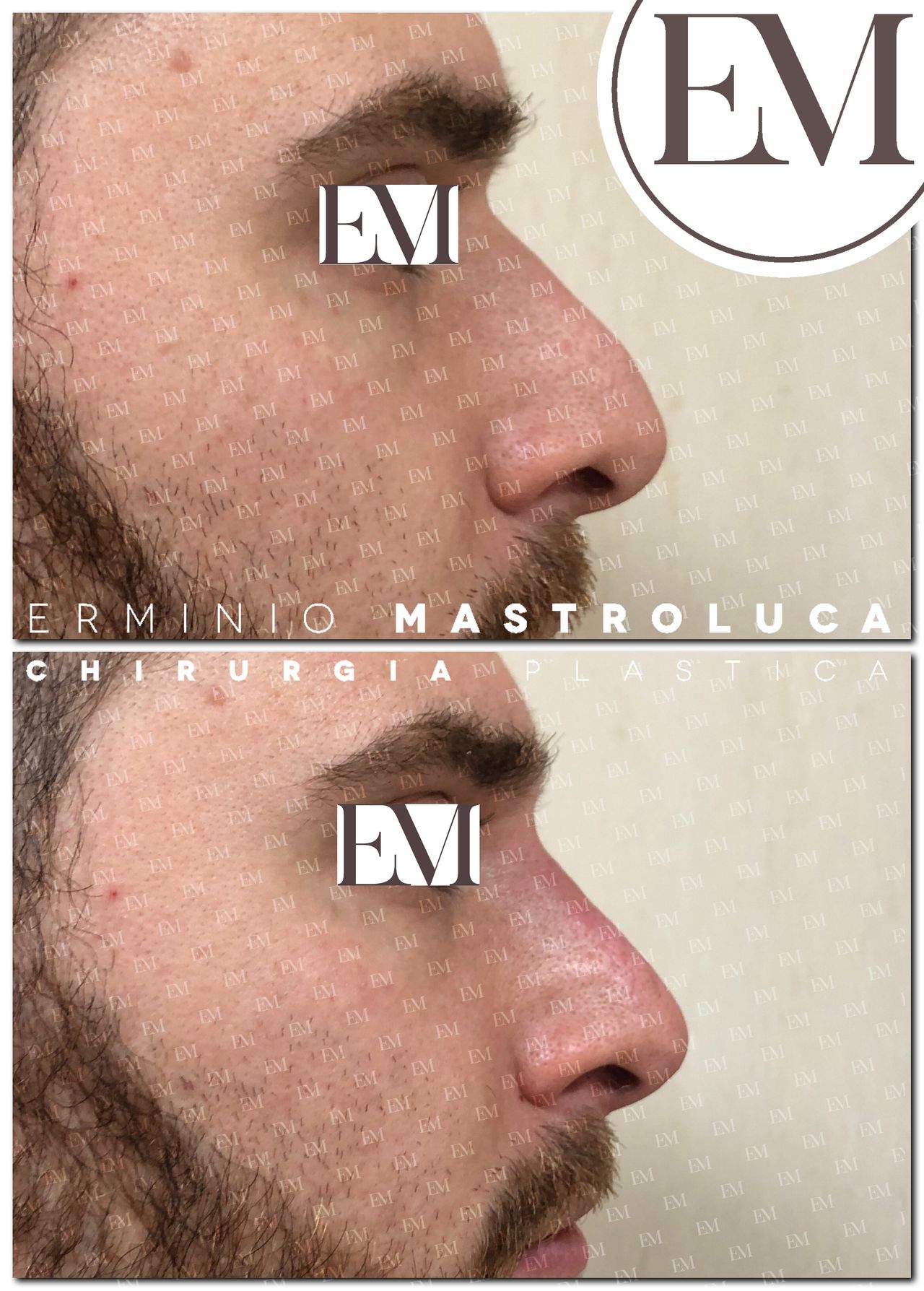 Erminio Mastroluca-1