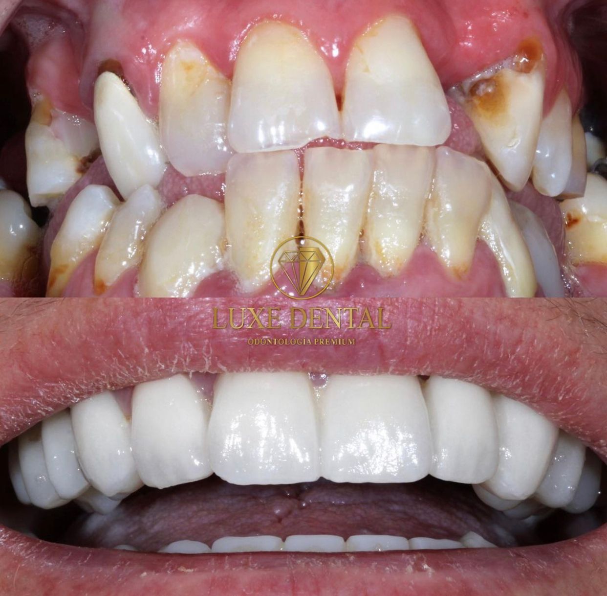 Ruben Patier Martin-16