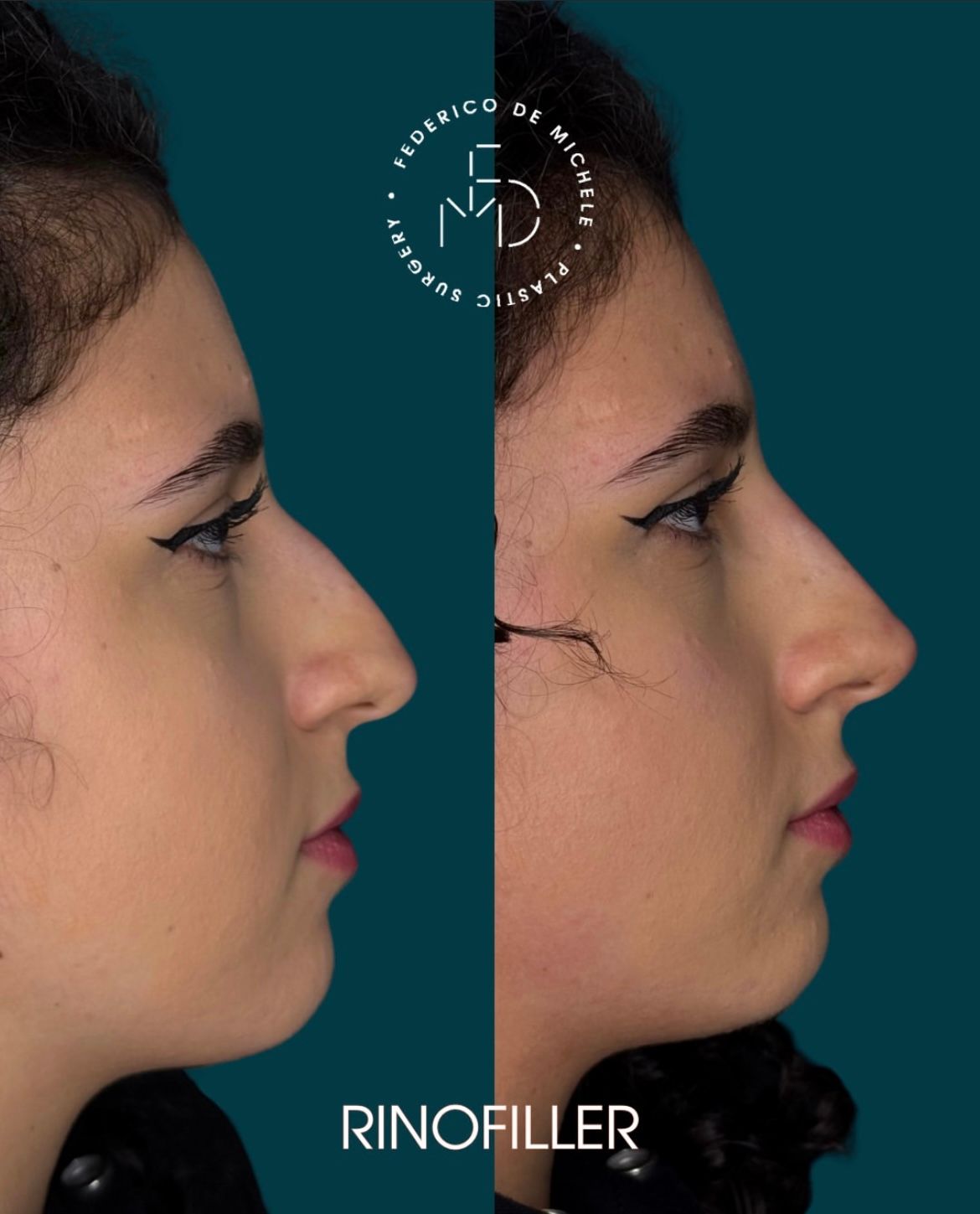 Federico De Michele-15