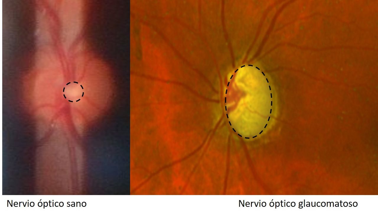 Telmo Xabier Lertxundi Plaza-4