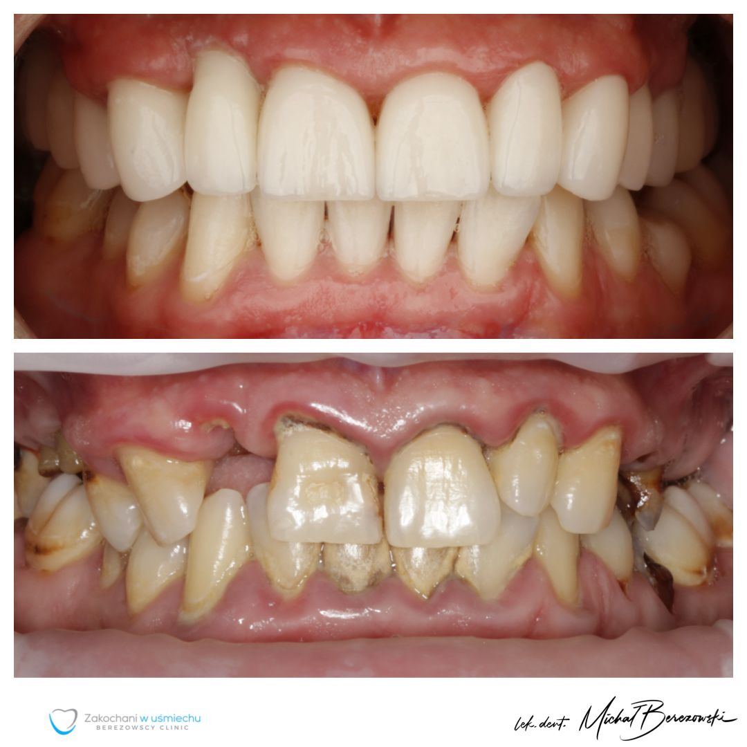 Michał Berezowski-9