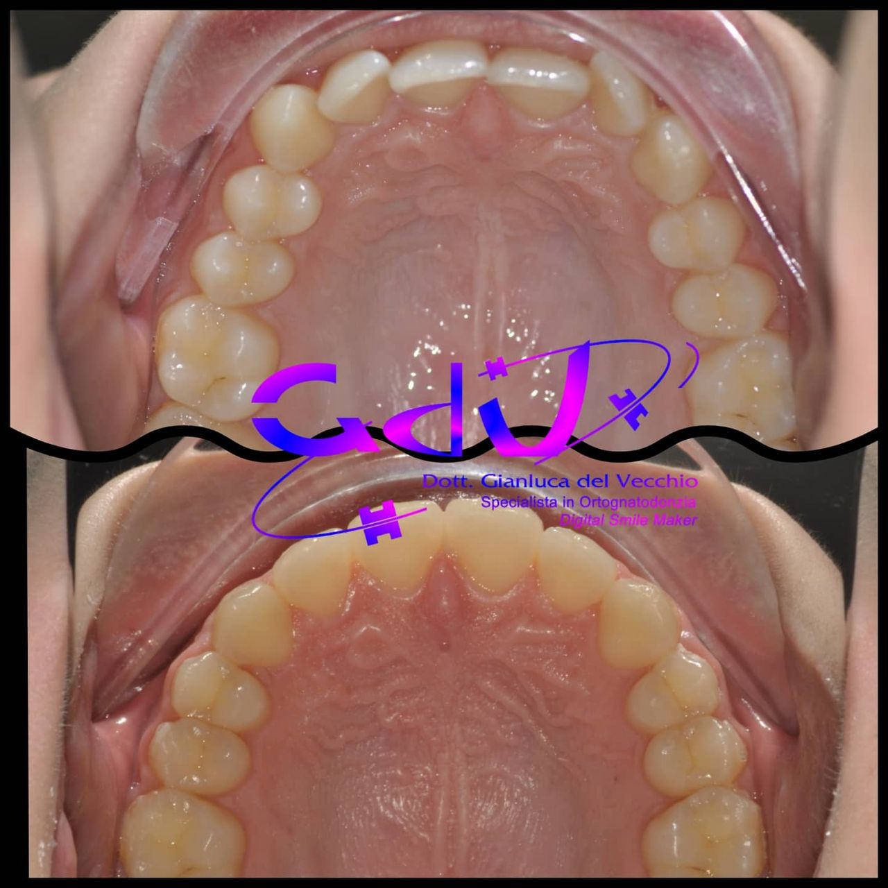 Gianluca Del Vecchio-168