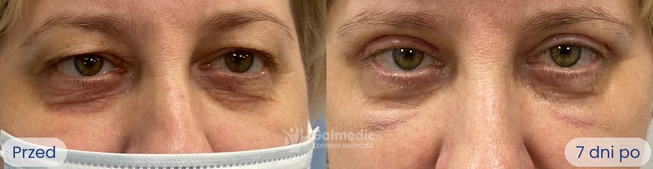 Jakub Staniszewski-3