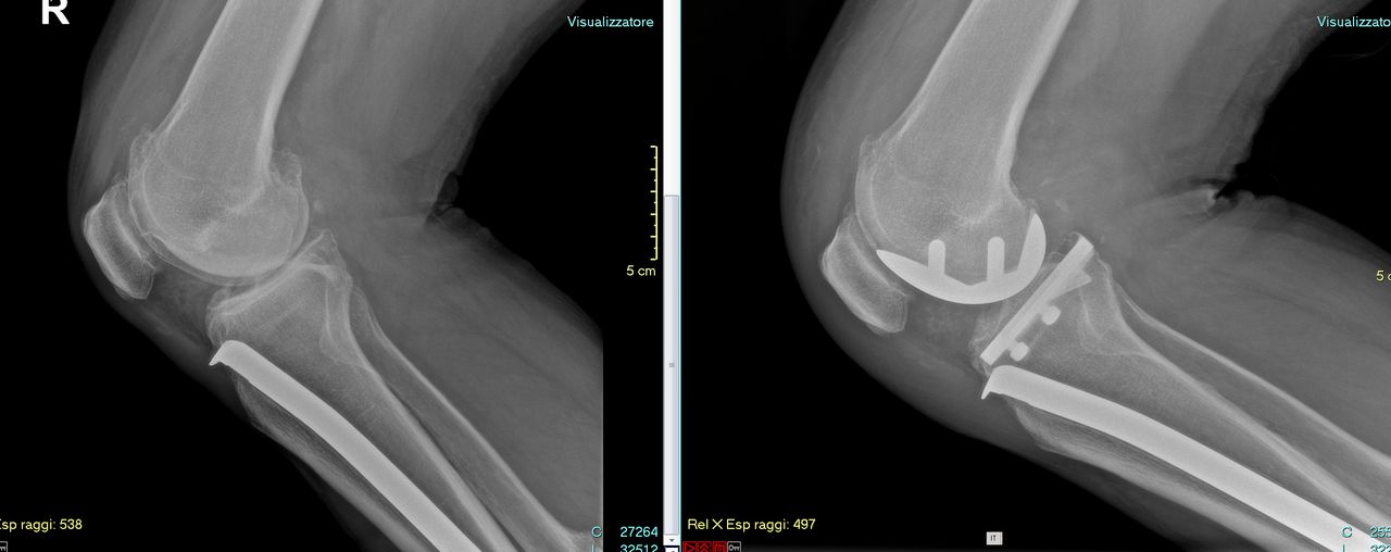 Luca Diego Serrao-10